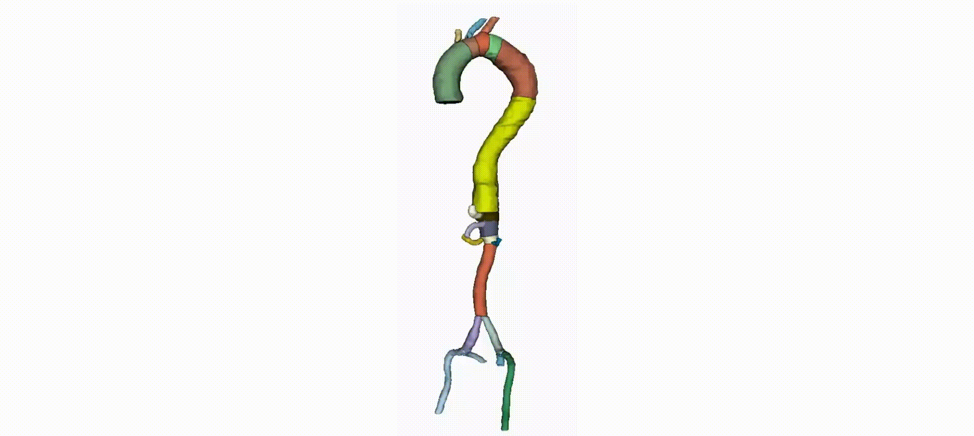 Animated 3D visualization of segmented aortic anatomy