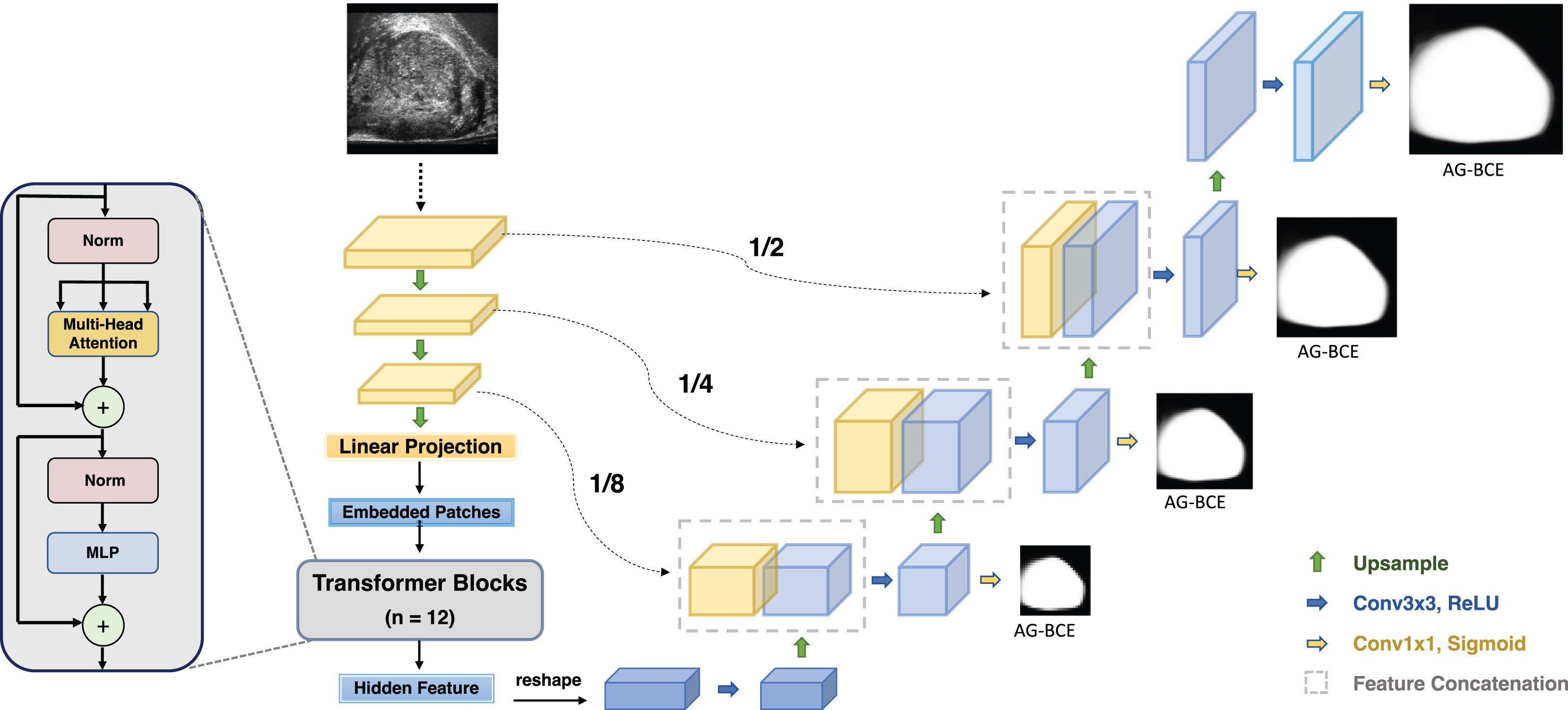 MicroSegNet: deep learning approach for prostate segmentation