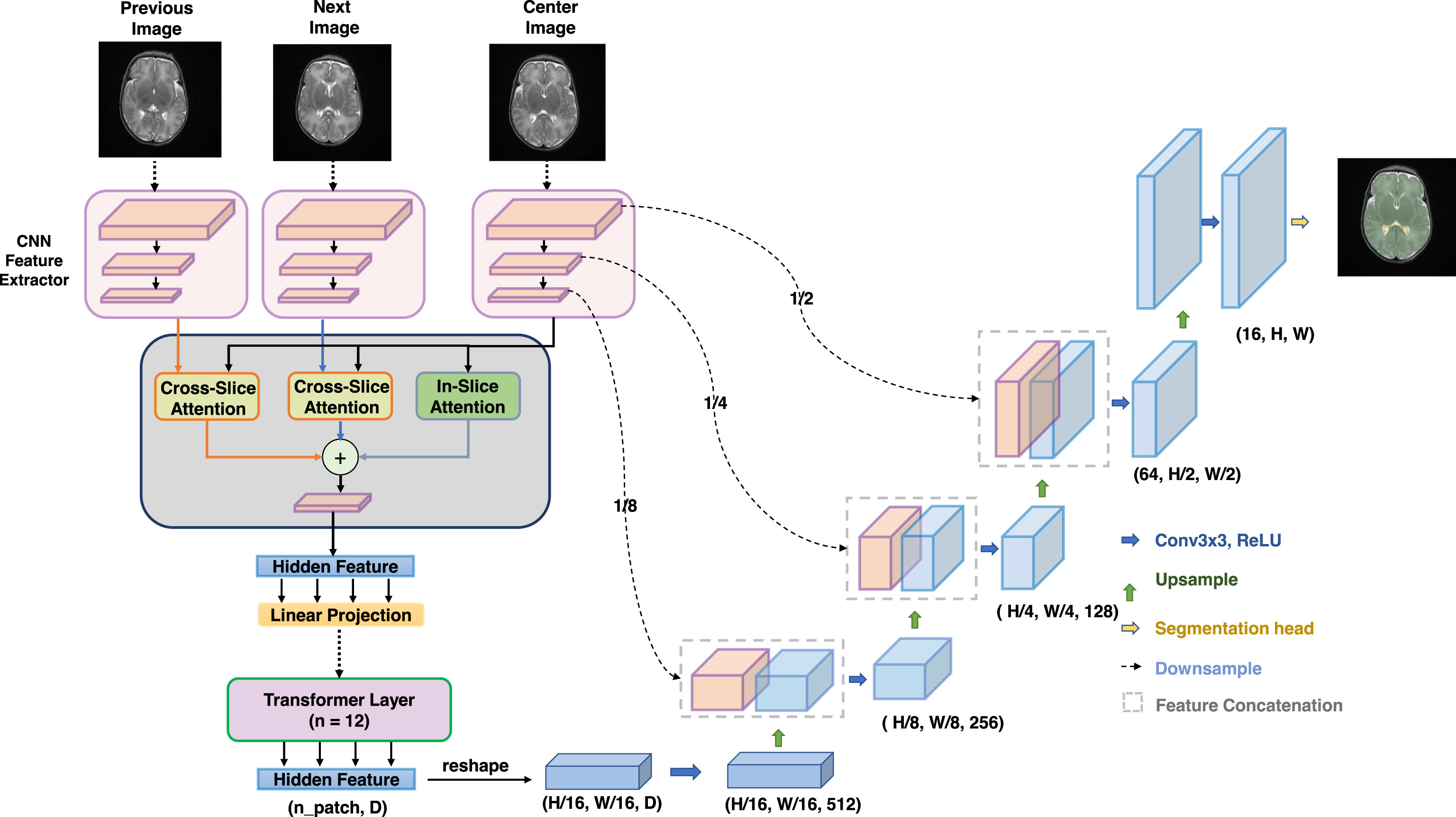A flexible 2.5D medical image segmentation approach