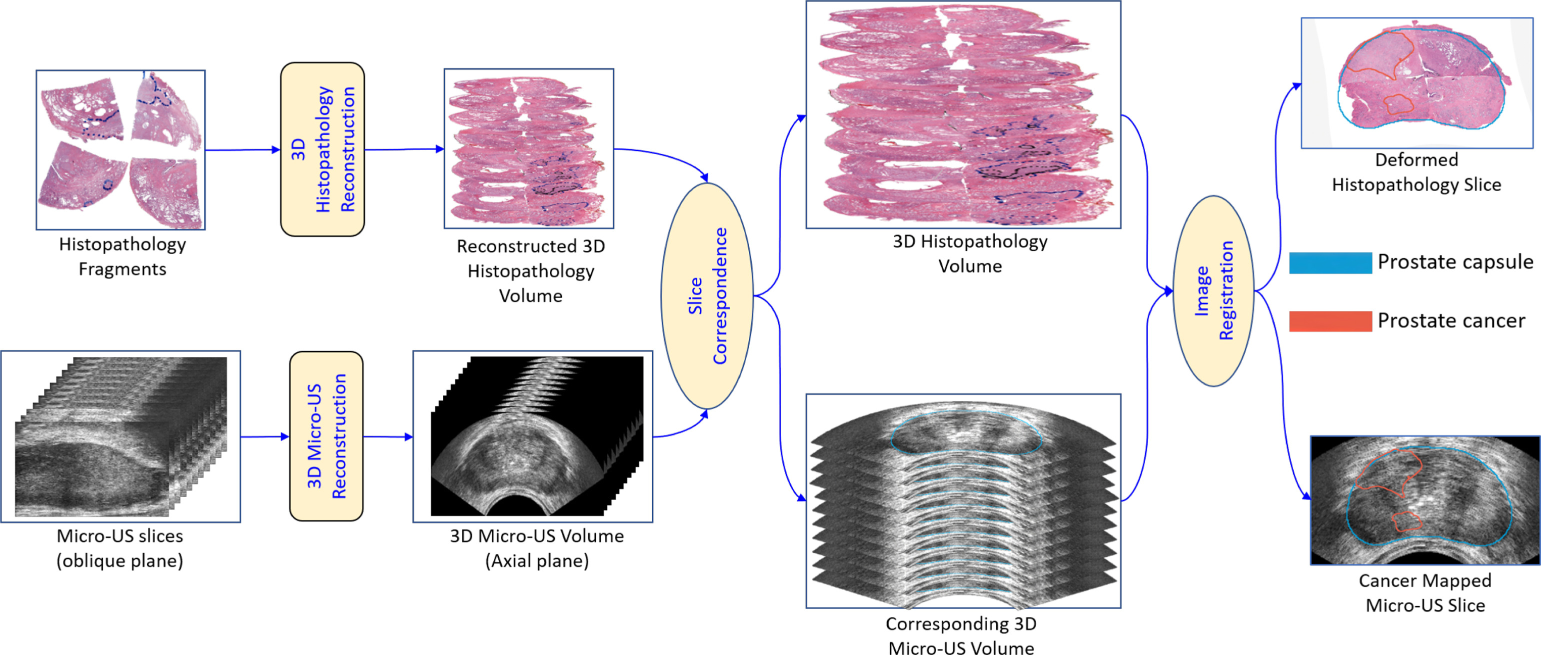 Image registration of in vivo micro-ultrasound and ex vivo histopathology